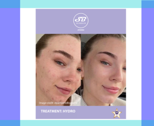 SkinBase Hydro skin treatments at the Letchworth Clinic
