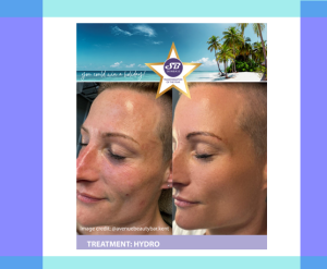 SkinBase Hydro skin treatments at the Letchworth Clinic